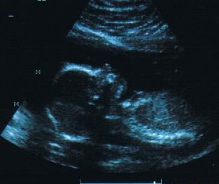 Election lies will not save this unborn baby.